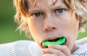 Kid Dentist in Thornhill that Specializes in Sport Mouth Guards